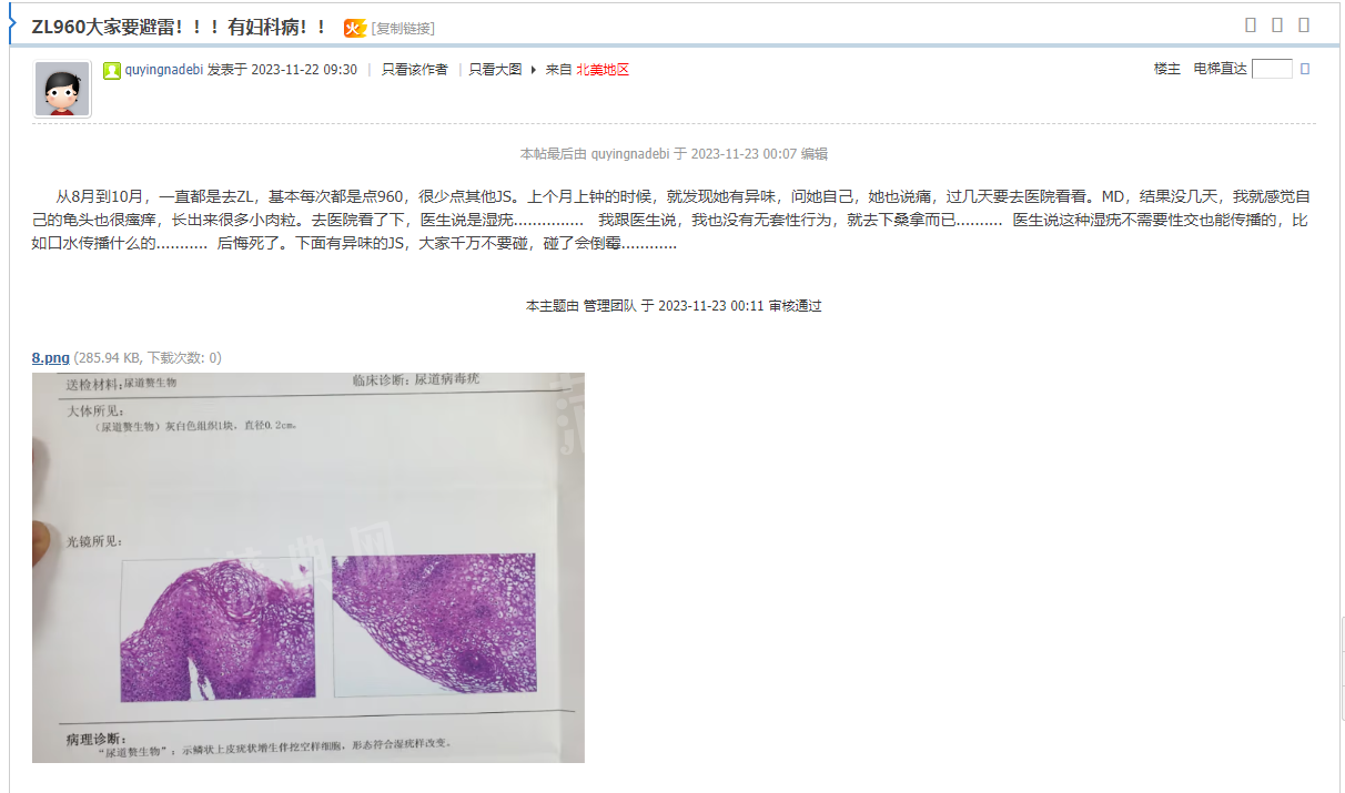 黑贴中的图